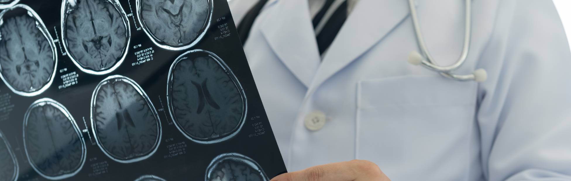 A doctor looking at a MRI image.