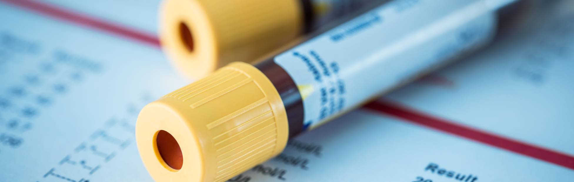An image of two blood test tubes on top of a blood test result document.